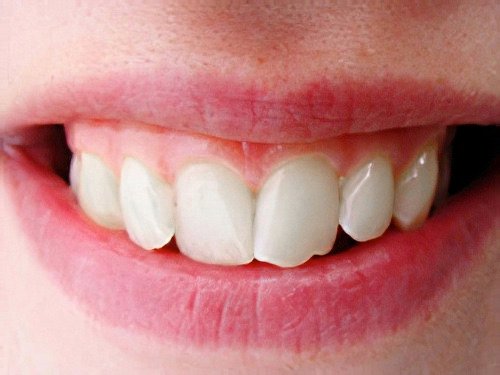 Orthodontie Le Fossat-2