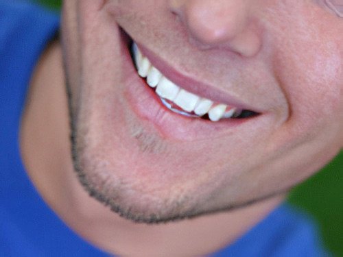 Esthétique dentaire le Fossat Sourire-01