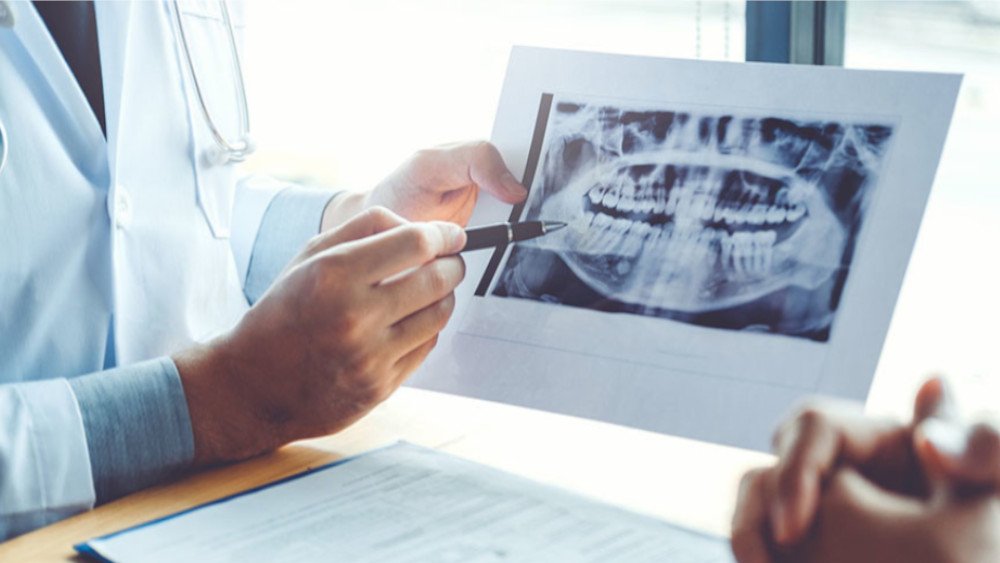 Informations patients dentaires Le Fossat