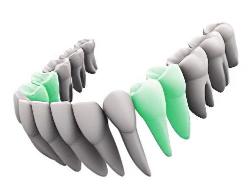 Dentiste Le Fossat