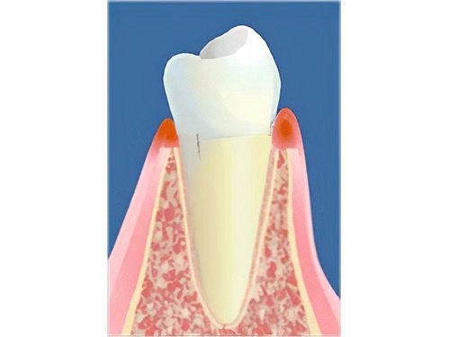 comment tiennent les dents